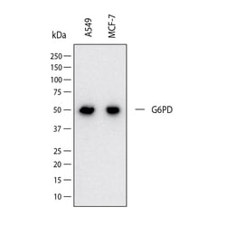 Human G6PD Antibody, R D Systems 100 &mu;g; Unconjugated:Antibodies, Monoclonal