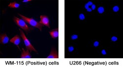 Human IGFBP-3 Antibody, R D Systems:Antibodies:Primary Antibodies