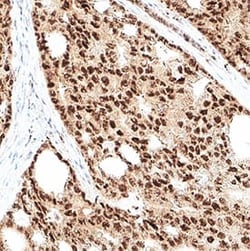 Novus Biologicals Human RBX1 Antibody, Novus Biologicals:Antibodies:Primary