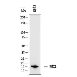 Novus Biologicals Human RBX1 Antibody, Novus Biologicals:Antibodies:Primary