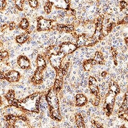 Novus Biologicals Human HLA Class I Antibody, Novus Biologicals 100 &mu;g,