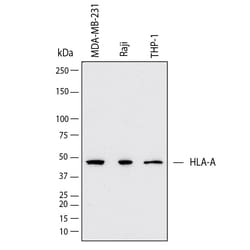 Novus Biologicals Human HLA Class I Antibody, Novus Biologicals 100 &mu;g,