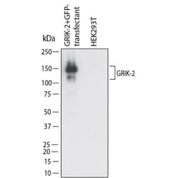 Human GluR6/GRIK2 Antibody, Novus Biologicals:Antibodies:Primary Antibodies