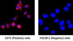 Human CD163 Antibody, Novus Biologicals:Anticuerpos:Anticuerpos primarios