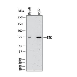 Human BTK Antibody, Novus Biologicals 25 &mu;g; Unconjugated:Antibodies,