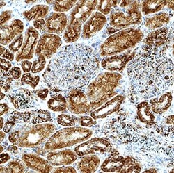 Human AMPK 1 Antibody, Novus Biologicals 25 &mu;g | Buy Online | R&D Systems | Fisher Scientific