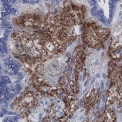 Human FGF-18 Antibody, R D Systems 25 &mu;g; Unconjugated:Antibodies, Monoclonal