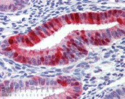 Metallothionein-1A Antibody (UC1MT), Novus Biologicals:Antibodies:Primary