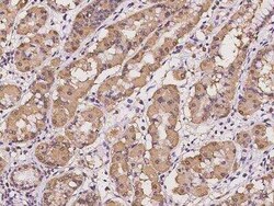 mitochondrial ribosomal protein L30 Antibody, Novus Biologicals 100 &mu;g | Buy Online | Novus Biologicals | Fisher Scientific