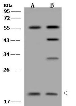 mitochondrial ribosomal protein L30 Antibody, Novus Biologicals 100 &mu;g | Buy Online | Novus Biologicals | Fisher Scientific