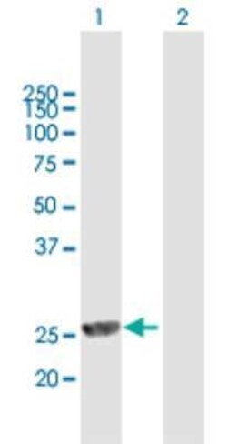 mpp8 Antibody, Novus Biologicals 0.05 mg | Buy Online | Novus Biologicals | Fisher Scientific