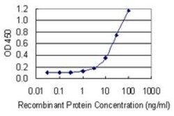 mtRNA polymerase Antibody (3D9), Novus Biologicals 0.1 mg | Buy Online | Novus Biologicals | Fisher Scientific