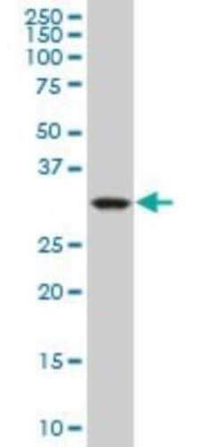 mu Crystallin Antibody (1C6), Novus Biologicals 0.1 mg | Buy Online | Novus Biologicals | Fisher Scientific