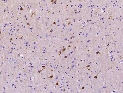 mu Crystallin Antibody, Novus Biologicals:Antibodies:Primary Antibodies