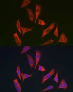 myosin X Antibody - BSA Free, Novus Biologicals 0.1 mL; Unconjugated:Antibodies,