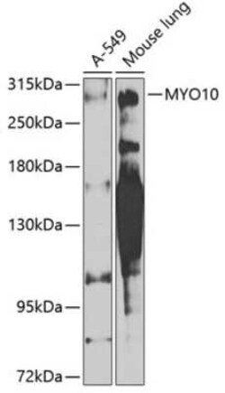 myosin X Antibody - BSA Free, Novus Biologicals 0.02 mL; Unconjugated:Antibodies,