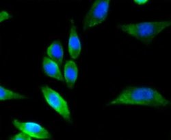 nNOS Rabbit anti-Human, Clone: ST520, Novus Biologicals 100&mu;L:Antibodies,