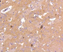 nNOS Rabbit anti-Human, Clone: ST520, Novus Biologicals 100&mu;L:Antibodies,