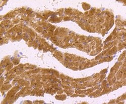 nNOS Rabbit anti-Human, Clone: ST520, Novus Biologicals 100&mu;L:Antibodies,