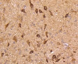 nNOS Rabbit anti-Human, Clone: ST520, Novus Biologicals 100&mu;L:Antibodies,