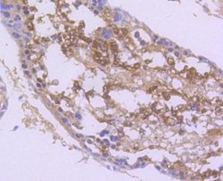 nNOS Rabbit anti-Human, Clone: ST520, Novus Biologicals 100&mu;L:Antibodies,