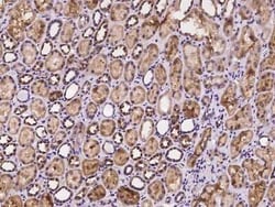 nSMase Antibody, Novus Biologicals 50 &mu;g, Unconjugated:Antibodies, Polyclonal