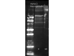 alpha 2-Macroglobulin Antibody, HRP, Novus Biologicals 0.1 mg; HRP:Antibodies,