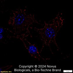 CD11b Antibody (M1/70.15) - BSA Free, Novus Biologicals 0.1mg; Unlabeled:Antibodies,