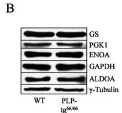 Aldolase A Antibody, Novus Biologicals 100 &mu;g; Unconjugated:Antikörper