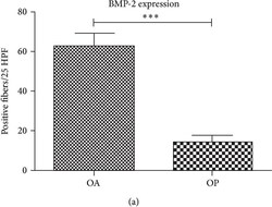 BMP-2 Antibody - BSA Free, Novus Biologicals:Antibodies:Primary Antibodies