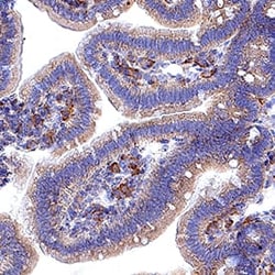 ChemR23/CMKLR1 Antibody (BZ194) - BSA Free, Novus Biologicals 0.05 mg;