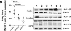 MUC1 Antibody - BSA Free, Novus Biologicals 0.025 mg; Unconjugated:Antibodies,