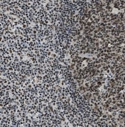 SSB Antibody, Novus Biologicals:Antibodies:Primary Antibodies