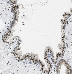 SSB Antibody, Novus Biologicals:Antibodies:Primary Antibodies