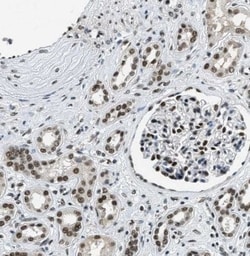 SSB Antibody, Novus Biologicals:Antibodies:Primary Antibodies