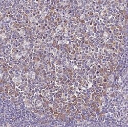 Abhd5 Antibody, Novus Biologicals 25 &mu;L; Unconjugated:Antibodies, Polyclonal