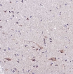 Abhd5 Antibody, Novus Biologicals 25 &mu;L; Unconjugated:Antibodies, Polyclonal