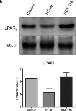 LPAR2/LPA2/EDG-4 Antibody, Novus Biologicals 0.1 mL; Unconjugated:Antibodies,