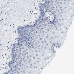 CD42b/GPIb alpha Antibody, Novus Biologicals:Antibodies:Primary Antibodies