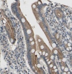 CDCP1 Antibody, Novus Biologicals 0.1 mL | Buy Online | Novus Biologicals | Fisher Scientific