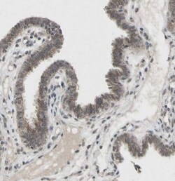 CDCP1 Antibody, Novus Biologicals 0.1 mL | Buy Online | Novus Biologicals | Fisher Scientific