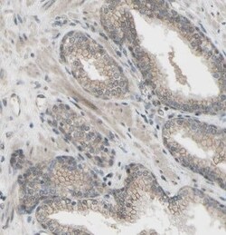 CDCP1 Antibody, Novus Biologicals 0.1 mL | Buy Online | Novus Biologicals | Fisher Scientific
