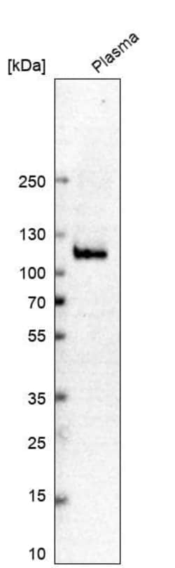 Plasminogen Antibody, Novus Biologicals 0.1 mL | Buy Online | Novus Biologicals | Fisher Scientific
