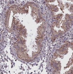 FEM1B Antibody, Novus Biologicals 25 &mu;L | Buy Online | Novus Biologicals | Fisher Scientific