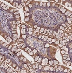 FEM1B Antibody, Novus Biologicals 25 &mu;L | Buy Online | Novus Biologicals | Fisher Scientific