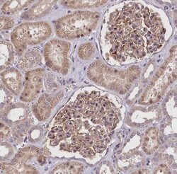 FEM1B Antibody, Novus Biologicals 25 &mu;L | Buy Online | Novus Biologicals | Fisher Scientific