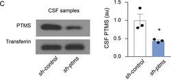 Transferrin Antibody, Novus Biologicals:Antibodies:Primary Antibodies