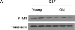 Transferrin Antibody, Novus Biologicals:Antibodies:Primary Antibodies