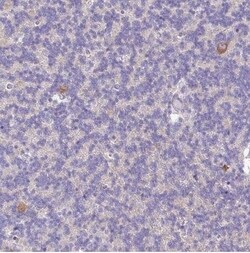 SLC38A1 Antibody, Novus Biologicals 25 &mu;L; Unconjugated:Antibodies,