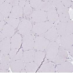 SLC38A1 Antibody, Novus Biologicals 25 &mu;L; Unconjugated:Antibodies,